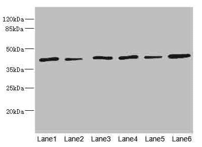 Western blot All lanes: TMOD1 antibody at 1.85ug/ml Lane 1: Mouse brain tissue Lane 2: Mouse lung tissue Lane 3: Hela whole cell lysate Lane 4: K562 whole cell lysate Lane 5: A549 whole cell lysate Lane 6: MCF-7 whole cell lysate Secondary Goat po...
