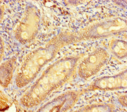 Immunohistochemistry of paraffin-embedded human small intestine tissue using CSB-PA023918LA01HU at dilution of 1:100