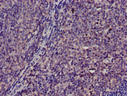 Immunohistochemistry of paraffin-embedded human lymph node tissue using CSB-PA023934LA01HU at dilution of 1:100