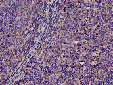 Immunohistochemistry of paraffin-embedded human lymph node tissue using CSB-PA023934LA01HU at dilution of 1:100