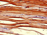 Immunohistochemistry of paraffin-embedded human skeletal muscle tissue using CSB-PA023951LA01HU at dilution of 1:100