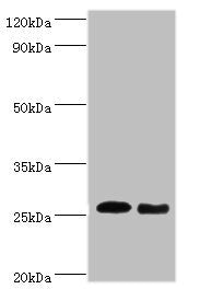 Western blot All lanes: Tumor necrosis factor antibody at dilution of 1: 1000 Lane 1: Tumor necrosis factor protein at 0.05ug Lane 2: Tumor necrosis factor protein at 0.5ug Secondary Goat polyclonal to rabbit IgG at 1/10000 dilution Predicted band...
