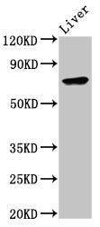 Western Blot Positive WB detected in: Mouse liver tissue All lanes: TNFAIP2 antibody at 6.9ug/ml Secondary Goat polyclonal to rabbit IgG at 1/50000 dilution Predicted band size: 73 kDa Observed band size: 73 kDa