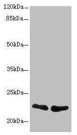 Western blot All lanes: TNFAIP8 antibody at 2.32µg/ml Lane 1: A431 whole cell lysate Lane 2: PC-3 whole cell lysate Secondary Goat polyclonal to rabbit IgG at 1/10000 dilution Predicted band size: 24, 23, 22, 25 kDa Observed band size: 22 kDa
