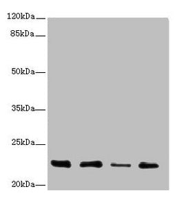 Western blot All lanes: TNFAIP8 antibody at 2.79µg/ml Lane 1: A431 whole cell lysate Lane 2: PC-3 whole cell lysate Lane 3: Human placenta tissue Lane 4: Mouse thymus tissue Secondary Goat polyclonal to rabbit IgG at 1/10000 dilution Predicted ban...