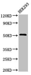 Western Blot Positive WB detected in: HEK293 whole cell lysate All lanes: TNFRSF10A antibody at 3.2ug/ml Secondary Goat polyclonal to rabbit IgG at 1/50000 dilution Predicted band size: 51 kDa Observed band size: 51 kDa