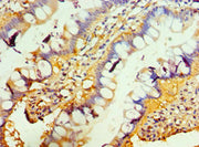 Immunohistochemistry of paraffin-embedded human small intestine tissue using CSB-PA023971DSR2HU at dilution of 1:100