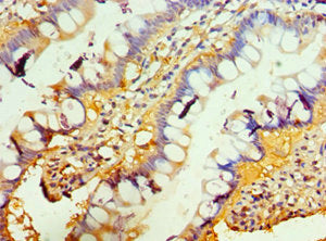 Immunohistochemistry of paraffin-embedded human small intestine tissue using CSB-PA023971DSR2HU at dilution of 1:100