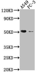Western Blot Positive WB detected in: A549 whole cell lysate, PC-3 whole cell lysate All lanes: TNFRSF1A antibody at 1:2000 Secondary Goat polyclonal to rabbit IgG at 1/50000 dilution Predicted band size: 51, 39, 26, 25 kDa Observed band size: 51 kDa
