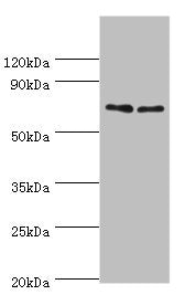 Western blot All lanes: TNFRSF21 antibody at 4ug/ml Lane 1: K562 whole cell lysate Lane 2: Jurkat whole cell lysate Secondary Goat polyclonal to rabbit IgG at 1/10000 dilution Predicted band size: 72 kDa Observed band size: 72 kDa