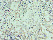 Immunohistochemistry of paraffin-embedded human prostate tissue using CSB-PA023987ESR1HU at dilution of 1:100