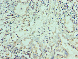 Immunohistochemistry of paraffin-embedded human prostate tissue using CSB-PA023987ESR1HU at dilution of 1:100