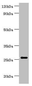 Western blot All lanes: Tumor necrosis factor ligand superfamily member 13 antibody at 10ug/ml + Hela whole cell lysate Secondary Goat polyclonal to rabbit IgG at 1/10000 dilution Predicted band size: 28, 26, 25, 37, 23 kDa Observed band size: 28 kDa