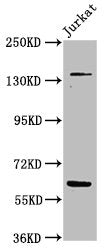 Western Blot Positive WB detected in: Jurkat whole cell lysate All lanes: TNKS antibody at 4.8µg/ml Secondary Goat polyclonal to rabbit IgG at 1/50000 dilution Predicted band size: 143, 68 kDa Observed band size: 143, 68 kDa