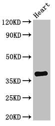 Western Blot Positive WB detected in: Mouse heart tissue All lanes: TNMD antibody at 2.8ug/ml Secondary Goat polyclonal to rabbit IgG at 1/50000 dilution Predicted band size: 38, 24, 31 kDa Observed band size: 38 kDa
