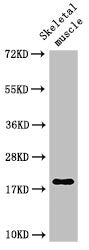 Western Blot Positive WB detected in: Rat skeletal muscle tissue All lanes: TNNC1 antibody at 3ug/ml Secondary Goat polyclonal to rabbit IgG at 1/50000 dilution Predicted band size: 19 kDa Observed band size: 19 kDa