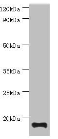 Western blot All lanes: TNNC2 antibody at 10ug/ml + Mouse skeletal muscle tissue Secondary Goat polyclonal to rabbit IgG at 1/10000 dilution Predicted band size: 18 kDa Observed band size: 18 kDa