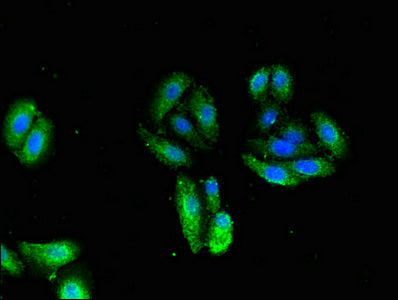 Immunofluorescent analysis of HepG2 cells using CSB-PA024011LA01HU at dilution of 1:100 and Alexa Fluor 488-congugated AffiniPure Goat Anti-Rabbit IgG(H+L)