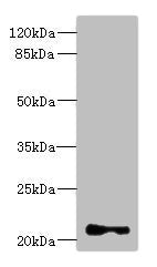 Western blot All lanes: TNNI2 antibody at 3.83ug/ml + Mouse skeletal muscle tissue Secondary Goat polyclonal to rabbit IgG at 1/10000 dilution Predicted band size: 21 kDa Observed band size: 21 kDa