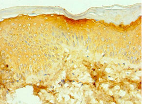 Immunohistochemistry of paraffin-embedded human skin tissue using CSB-PA024036ESR2HU at dilution of 1:100