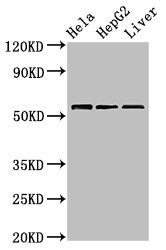 Western Blot Positive WB detected in: Hela whole cell lysate, HepG2 whole cell lysate, Mouse liver tissue All lanes: TOM1 antibody at 2.4µg/ml Secondary Goat polyclonal to rabbit IgG at 1/50000 dilution Predicted band size: 54, 49, 51 kDa Observed...