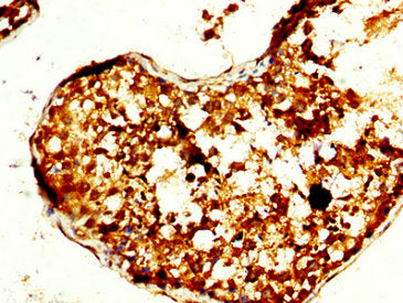 IHC image of CSB-PA024044LA01HU diluted at 1:240 and staining in paraffin-embedded human testis tissue performed on a Leica BondTM system. After dewaxing and hydration, antigen retrieval was mediated by high pressure in a citrate buffer (pH 6.0)....