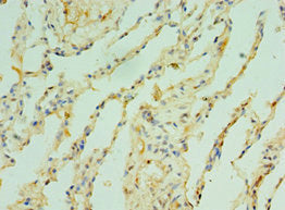 Immunohistochemistry of paraffin-embedded human lung tissue using CSB-PA024050ESR1HU at dilution of 1:100