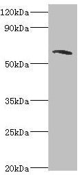 Western blot All lanes: TOMM70A antibody at 6µg/ml + MCF-7 whole cell lysate Secondary Goat polyclonal to rabbit IgG at 1/10000 dilution Predicted band size: 67 kDa Observed band size: 67 kDa