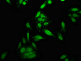 Immunofluorescence staining of Hela cells with CSB-PA024056LA01HU at 1:166, counter-stained with DAPI. The cells were fixed in 4% formaldehyde, permeabilized using 0.2% Triton X-100 and blocked in 10% normal Goat Serum. The cells were then incubat...