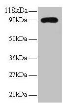 Western blot All lanes: RPL38 antibody at 2µg/ml + EC109 whole cell lysate Secondary Goat polyclonal to rabbit IgG at 1/15000 dilution Predicted band size: 90 kDa Observed band size: 90 kDa