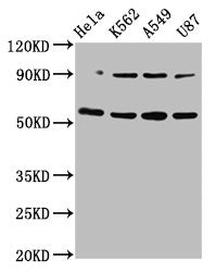 Western Blot Positive WB detected in: Hela whole cell lysate, K562 whole cell lysate, A549 whole cell lysate, U87 whole cell lysate All lanes: TOX antibody at 5.2µg/ml Secondary Goat polyclonal to rabbit IgG at 1/50000 dilution Predicted band size...