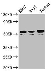 Western Blot Positive WB detected in: K562 whole cell lysate, Raji whole cell lysate, Jurkat whole cell lysate All lanes: TOX2 antibody at 4.3µg/ml Secondary Goat polyclonal to rabbit IgG at 1/50000 dilution Predicted band size: 52, 55, 50, 54 kDa...