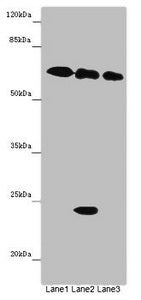 Western blot All lanes: TOX3 antibody at 9 ug/ml Lane 1: Mouse heart tissue Lane 2: Mouse spleen tissue Lane 3: Mouse brain tissue Secondary Goat polyclonal to rabbit IgG at 1/10000 dilution Predicted band size: 63 kDa Observed band size: 63, 24 kDa