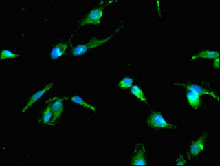 Immunofluorescent analysis of Hela cells using CSB-PA024082LA01HU at dilution of 1:100 and Alexa Fluor 488-congugated AffiniPure Goat Anti-Rabbit IgG(H+L)