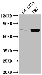 Western Blot Positive WB detected in: SH-SY5Y whole cell lysate, U87 whole cell lysate All lanes: TP73 antibody at 1:2000 Secondary Goat polyclonal to rabbit IgG at 1/50000 dilution Predicted band size: 70, 55, 54, 45, 62, 60, 65, 50, 48, 63, 39 k...