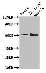 Western Blot Positive WB detected in: Mouse heart tissue, Mouse skeletal muscle tissue All lanes: TPH1 antibody at 2.5µg/ml Secondary Goat polyclonal to rabbit IgG at 1/50000 dilution Predicted band size: 51, 54 kDa Observed band size: 51 kDa