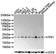 Western blot All lanes: TPK1 antibody at 0.78ug/ml Lane 1: Mouse liver tissue Lane 2: Mouse kidney tissue Secondary Goat polyclonal to rabbit IgG at 1/10000 dilution Predicted band size: 28, 14 kDa Observed band size: 28 kDa