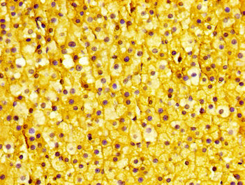 IHC image of CSB-PA024113LA01HU diluted at 1:400 and staining in paraffin-embedded human adrenal gland tissue performed on a Leica BondTM system. After dewaxing and hydration, antigen retrieval was mediated by high pressure in a citrate buffer (pH...