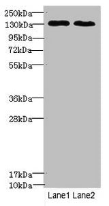 Western blot All lanes: TPP2antibody at 3.42ug/ml Lane 1: Hela whole cell lysate Lane 2: HepG2 whole cell lysate Secondary Goat polyclonal to rabbit IgG at 1/10000 dilution Predicted band size: 138 kDa Observed band size: 138 kDa