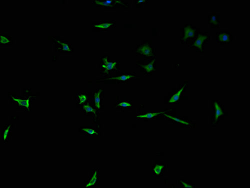 Immunofluorescence staining of SH-SY5Y cells with CSB-PA024114LA01HU at 1:100, counter-stained with DAPI. The cells were fixed in 4% formaldehyde and blocked in 10% normal Goat Serum. The cells were then incubated with the antibody overnight at 4°...