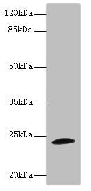 Western blot All lanes: TPPP antibody IgG at 1.71ug/ml + Mouse brain tissue Secondary Goat polyclonal to rabbit IgG at 1/10000 dilution Predicted band size: 24 kDa Observed band size: 24 kDa