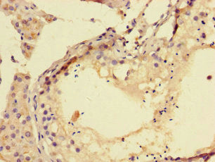 Immunohistochemistry of paraffin-embedded human testis tissue using CSB-PA024117LA01HU at dilution of 1:100
