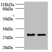 Western blot All lanes: Tpsb2 antibody at 2µg/ml Lane 1: Mouse heart tissue Lane 2: Rat heart tissue Secondary Goat polyclonal to rabbit IgG at 1/10000 dilution Predicted band size: 31, 26 kDa Observed band size: 31 kDa