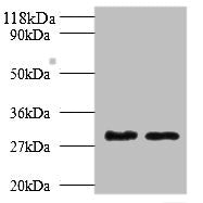 Western blot All lanes: Tpsb2 antibody at 2µg/ml Lane 1: Mouse heart tissue Lane 2: Rat heart tissue Secondary Goat polyclonal to rabbit IgG at 1/10000 dilution Predicted band size: 31, 26 kDa Observed band size: 31 kDa