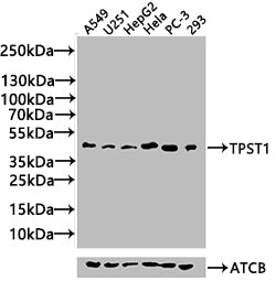Western Blot Positive WB detected in: Mouse Skeletal Muscle tissue lysate(20µg),Rat Skeletal Muscle tissue lysate(20µg) All lanes: TPST1 antibody at 1:1000 Secondary Goat polyclonal to rabbit IgG at 1/40000 dilution Predicted band size: 42.2 kDa O...