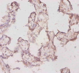 Immunohistochemistry of paraffin-embedded human placenta tissue using CSB-PA024134HA01MO at dilution of 1:20