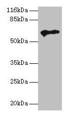Western blot All lanes: TPTE antibody at 2µg/ml + HepG2 whole cell lysate Secondary Goat polyclonal to rabbit IgG at 1/10000 dilution Predicted band size: 65, 63, 61, 50 kDa Observed band size: 65 kDa