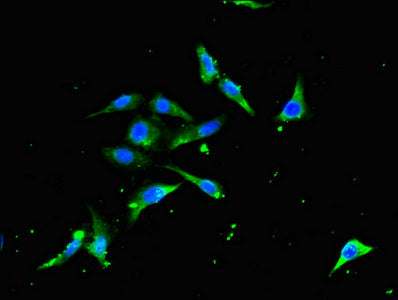 Immunofluorescent analysis of Hela cells using CSB-PA024148LA01HU at dilution of 1:100 and Alexa Fluor 488-congugated AffiniPure Goat Anti-Rabbit IgG(H+L)