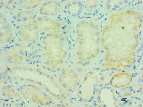 Immunohistochemistry of paraffin-embedded human kidney tissue using CSB-PA024153ESR1HU at dilution of 1:100