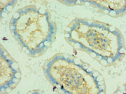 Immunohistochemistry of paraffin-embedded human small intestine tissue using CSB-PA024153ESR2HU at dilution of 1:100